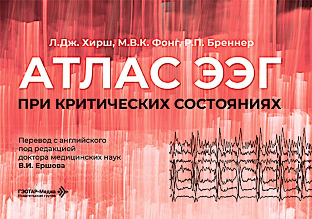 Атлас ЭЭГ при критических состояниях