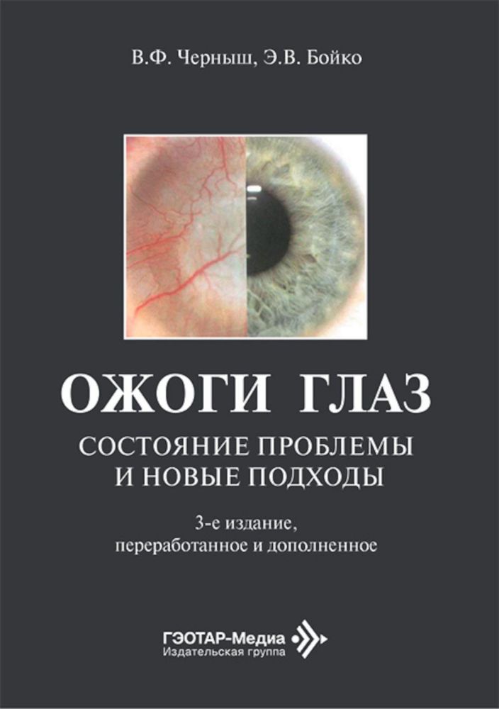 Ожоги глаз. Состояние проблемы и новые подходы. 3-е изд., перераб. и доп