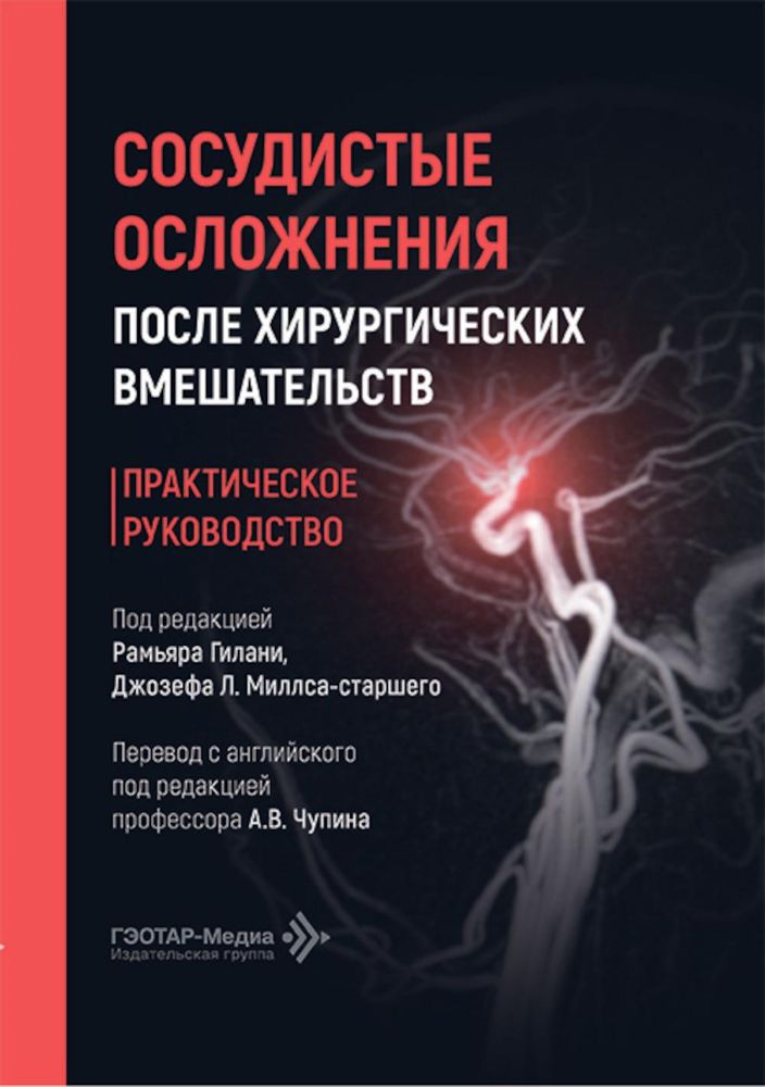 Сосудистые осложнения после хирургических вмешательств. Практическое руководство