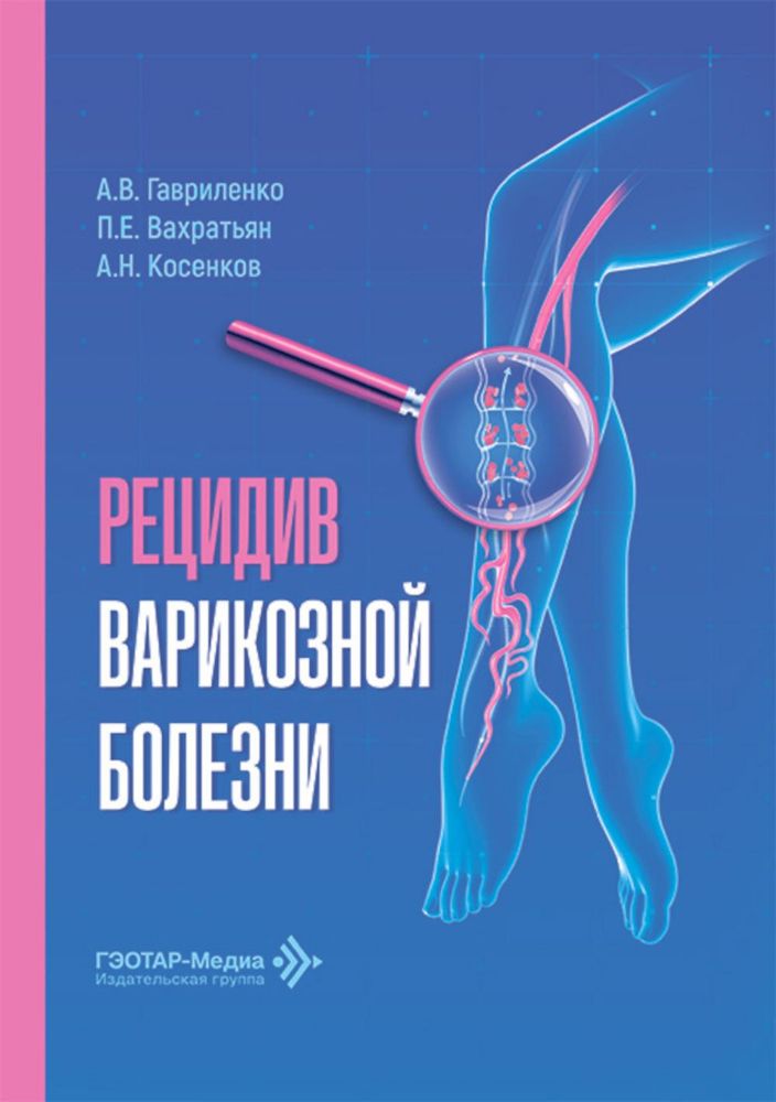 Рецидив варикозной болезни