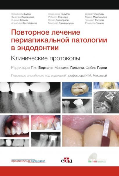 Повторное лечение периапикальной патологии в эндодонтии. Клинические протоколы