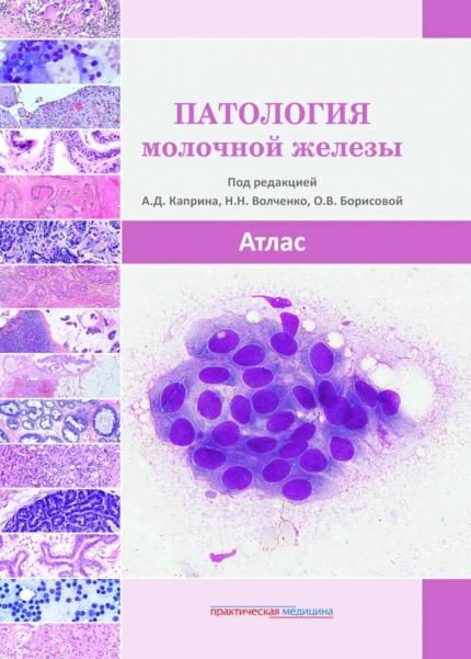Патология молочной железы. Атлас