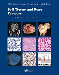 WHO Classification of Tumours: Soft Tissue and Bone Tumour. 5 Ed.