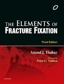 The Elements of Fracture Fixation, 3e
