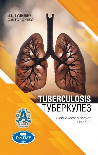 TUBERCULOSIS ТУБЕРКУЛЕЗ, ИЗД.1