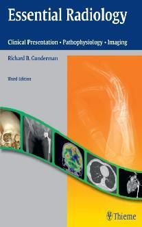 Essential Radiology: Clinical Presentation Pathophysiology Imaging.