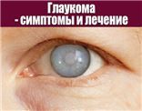 Глаукома