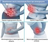 Аппендицит