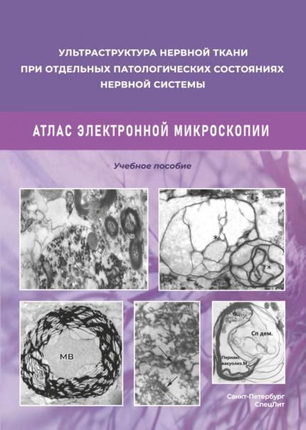 Ультраструктура нервной ткани при отдельных патологических состояниях нервной системы. Атлас электронной микроскопии: Учебное пособие