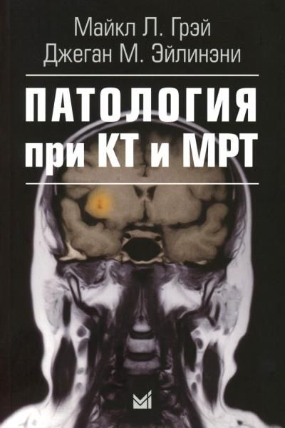 Патология при КТ и МРТ. 3-е изд
