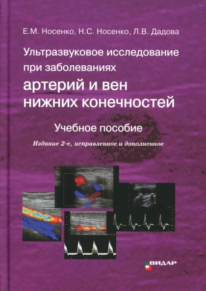 Ультразвуковое исследование при заболеваниях артерий и вен нижних конечностей: Учебное пособие. 2-е изд., испр.и доп
