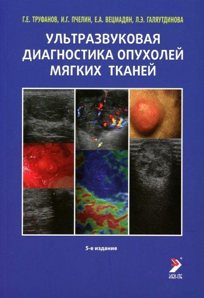 Ультразвуковая диагностика опухолей мягких тканей. 7-е изд